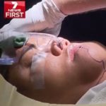 Tumour girl 1