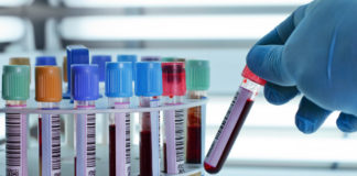 Health appalled by reports people falsified typhoid test samples as outbreak announced