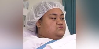 Tongan woman ready to return home after Australian surgeons remove tumour
