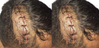 Hōfoa Police officer machete attack accused identified