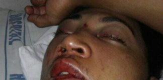 Man hospitalised with facial injuries after alleged brawl in Ha’apai