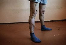 Flesh-eating Russian drug Krokodil that leaves addicts in a zombie-like state hits Australia