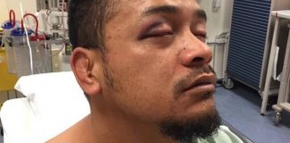 Fe‘aomoengalu’s injuries still mysterious after police deny responsibility