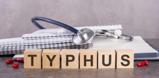 Person suspected to have typhus spread by fleas from cats or rodents