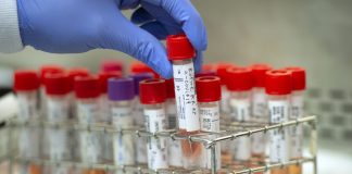 Covid-19: 12,383 new cases to report, 44 deaths