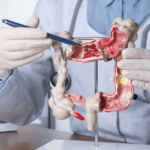 Intestine