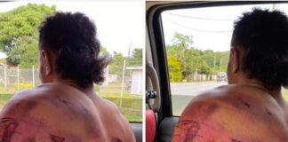 Photo of man suffering horrific bruising divides Tongan online community