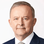 Anthony Albanese