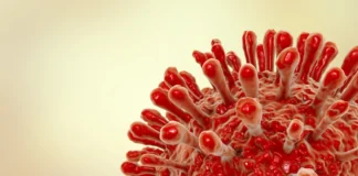 Fiji HIV outbreak: Too early to tell of impact on NZ, charity says