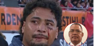 Positive Update: ‘Eliesa Kātoa moved from ICU following brain surgery