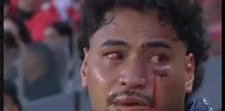 NRL proposes two-year ban for medics over concussion breaches in Eliesa Katoa case