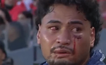 NRL proposes two-year ban for medics over concussion breaches in Eliesa Katoa case